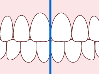 歯の図