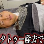後藤祐樹、首のタトゥー除去施術４回目。痛すぎ！！らしい